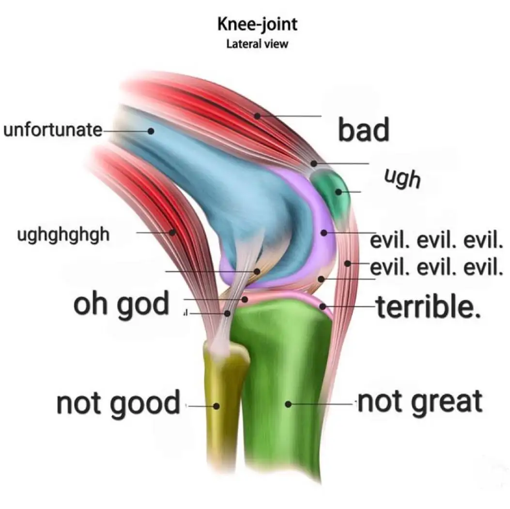 Knee joint meme marking all parts as bad