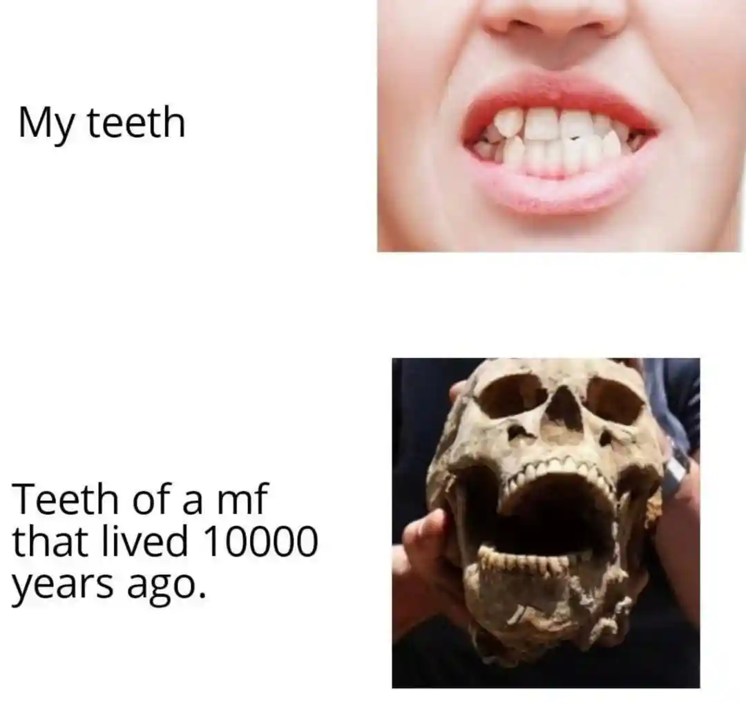 My teeth meme vs 10000 year old skull
