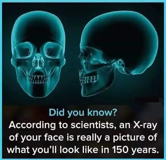 X ray skull meme fact about 150 years