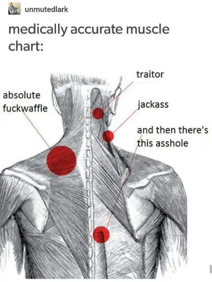Funny Muscle Chart meme marks silly back pain spots