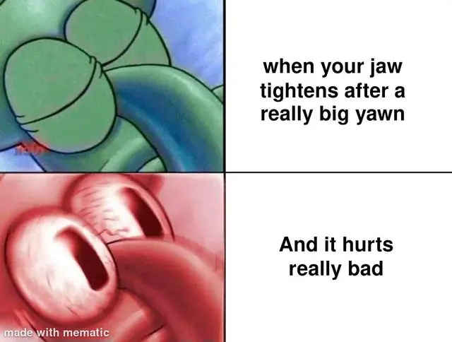 Big yawn jaw ache meme showing soreness